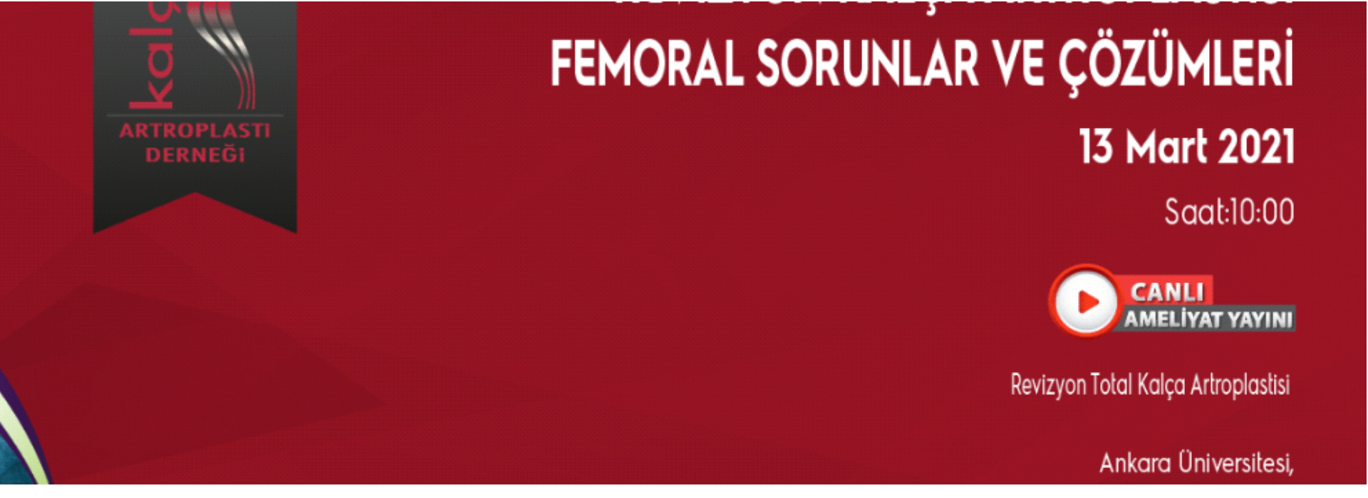 Revizyon Kalça Artroplastisinde Femoral Sorunlar ve Çözümleri, Canlı Yayın
